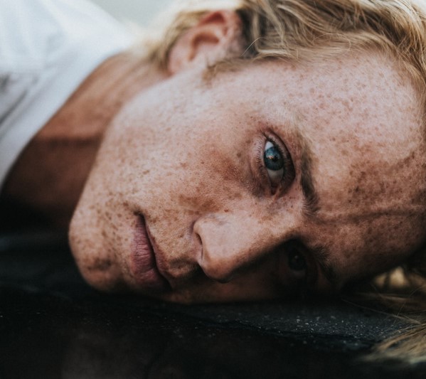 Hombre rubio con pecas